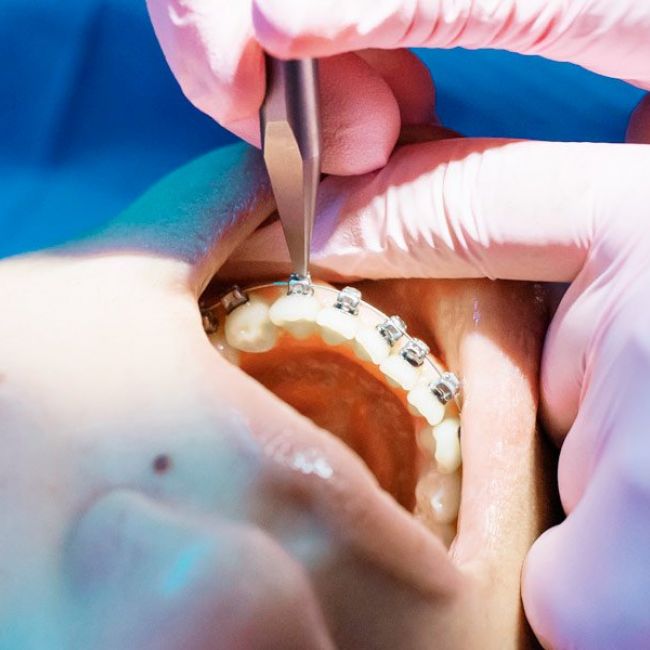 Ortodoncia con Rafael González Odontólogos